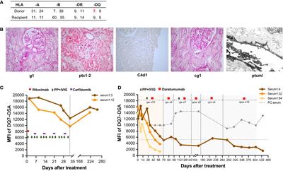 Case report: Daratumumab for treatment of refractory late or chronic active antibody-mediated rejection in renal allograft recipients with high levels of de novo donor-specific antibodies